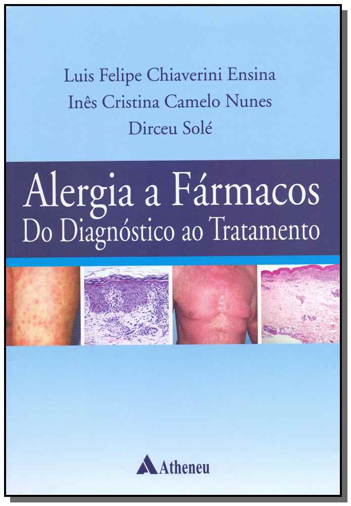Alergia a Fármacos - 01Ed/19