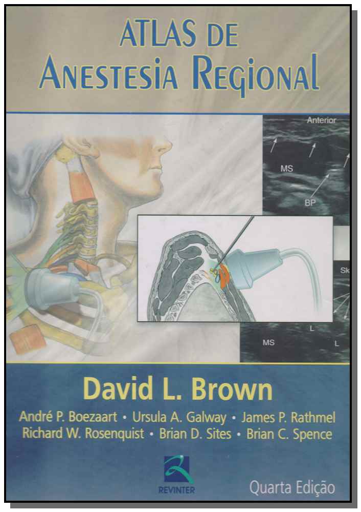 Atlas Anestesia Regional - 04Ed/14