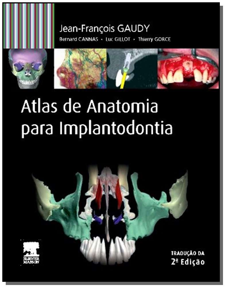 Atlas de Anatomia Para Implantodontia