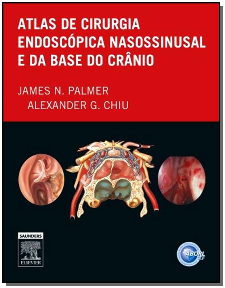 Atlas de Cirurgia Endoscopica Nasossinusal e da Ba