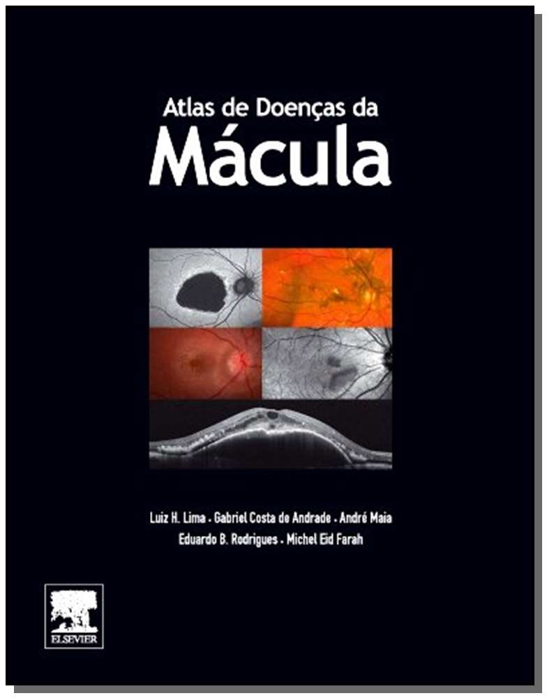 Atlas de Doencas de Macula
