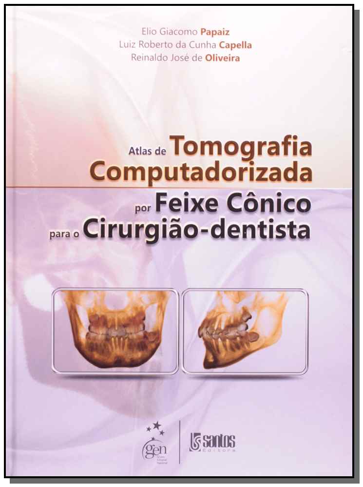 Atlas de Tomografia Computadorizada Por Feixe Cônico Para o Cirurgião-Dentista - 01Ed/11
