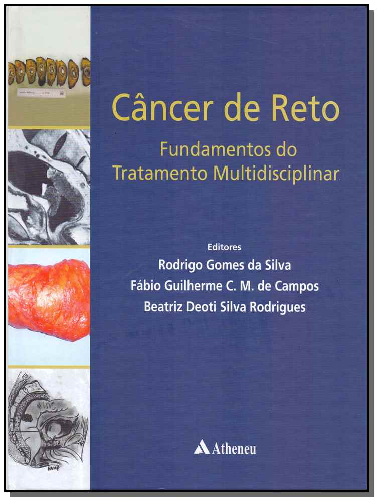Câncer de Reto - 01Ed17