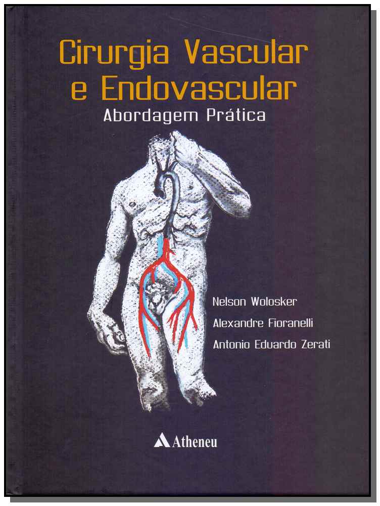 Cirugia Vascular e Endovascular - 01Ed/17
