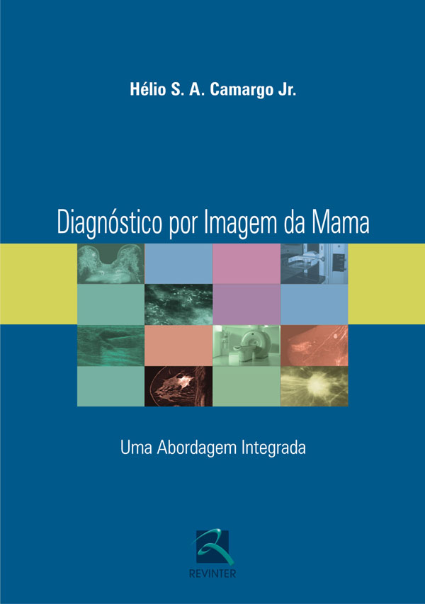 Diagnóstico Por Imagem Da Mama
