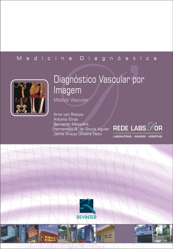 Diagnóstico Vascular Por Imagem