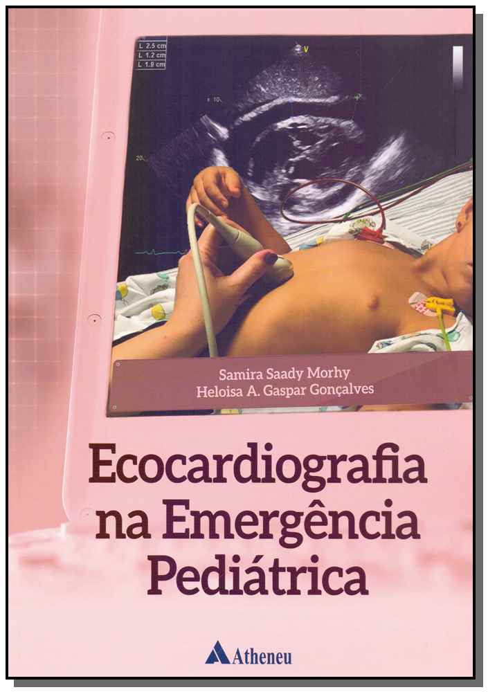 Ecocardiografia na Emergência Pediátrica