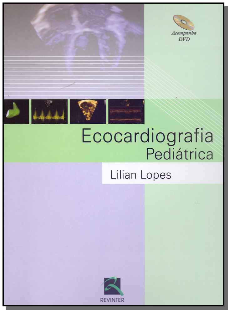 Ecocardiografia Pediátrica