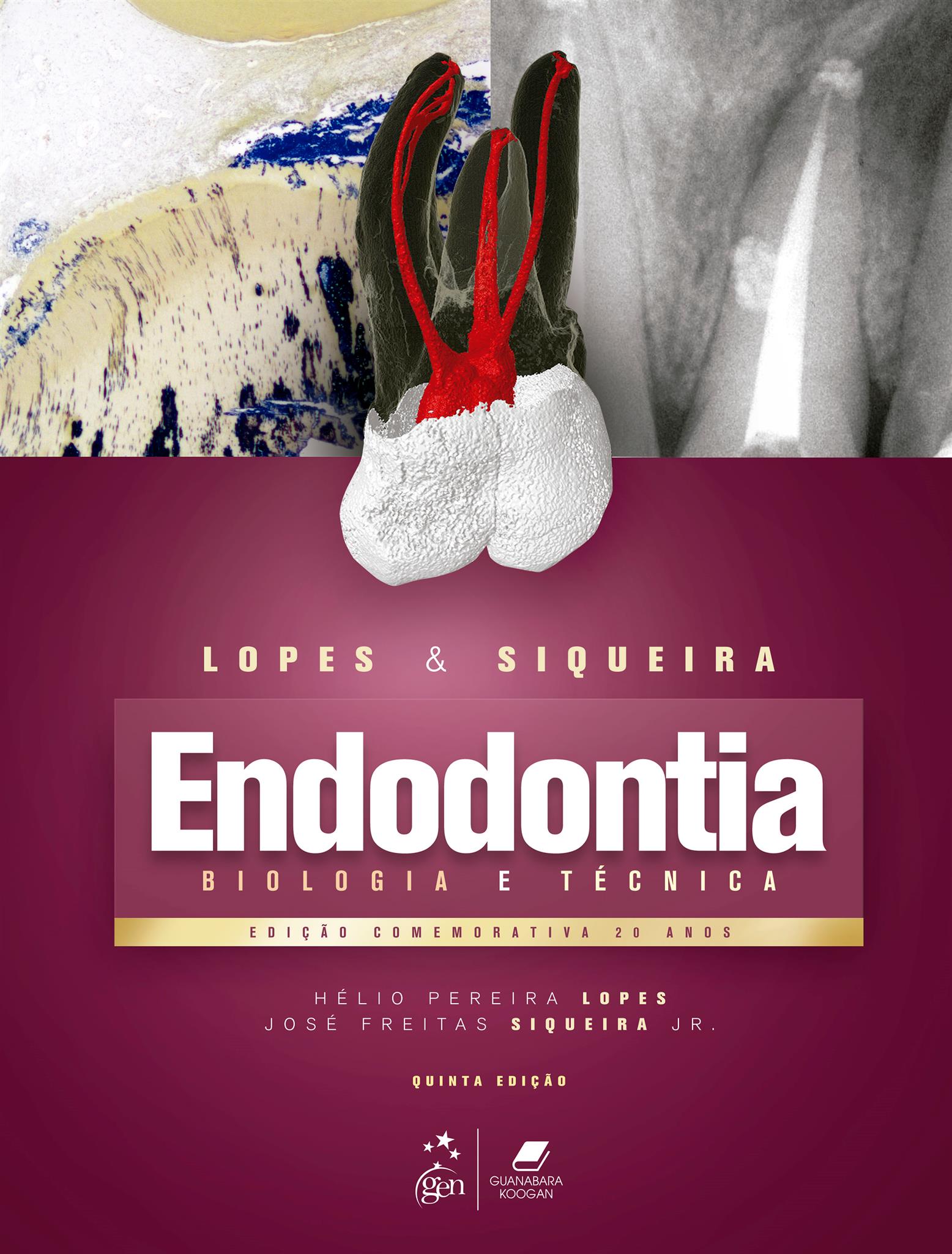 Endodontia - Biologia e Técnica - 05Ed/20