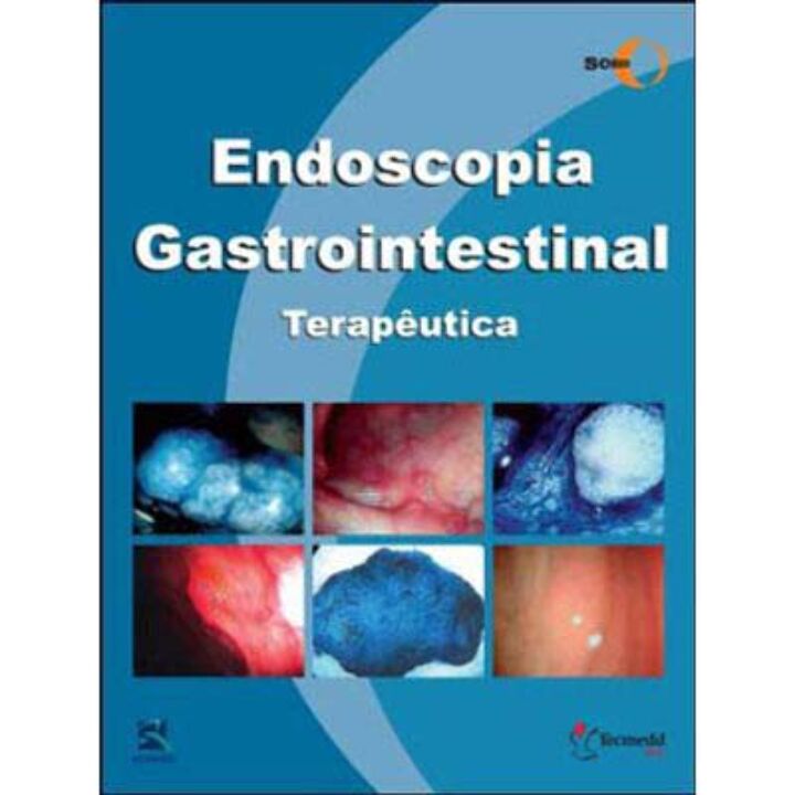 Endoscopia Gastrointestinal - Terapeutica