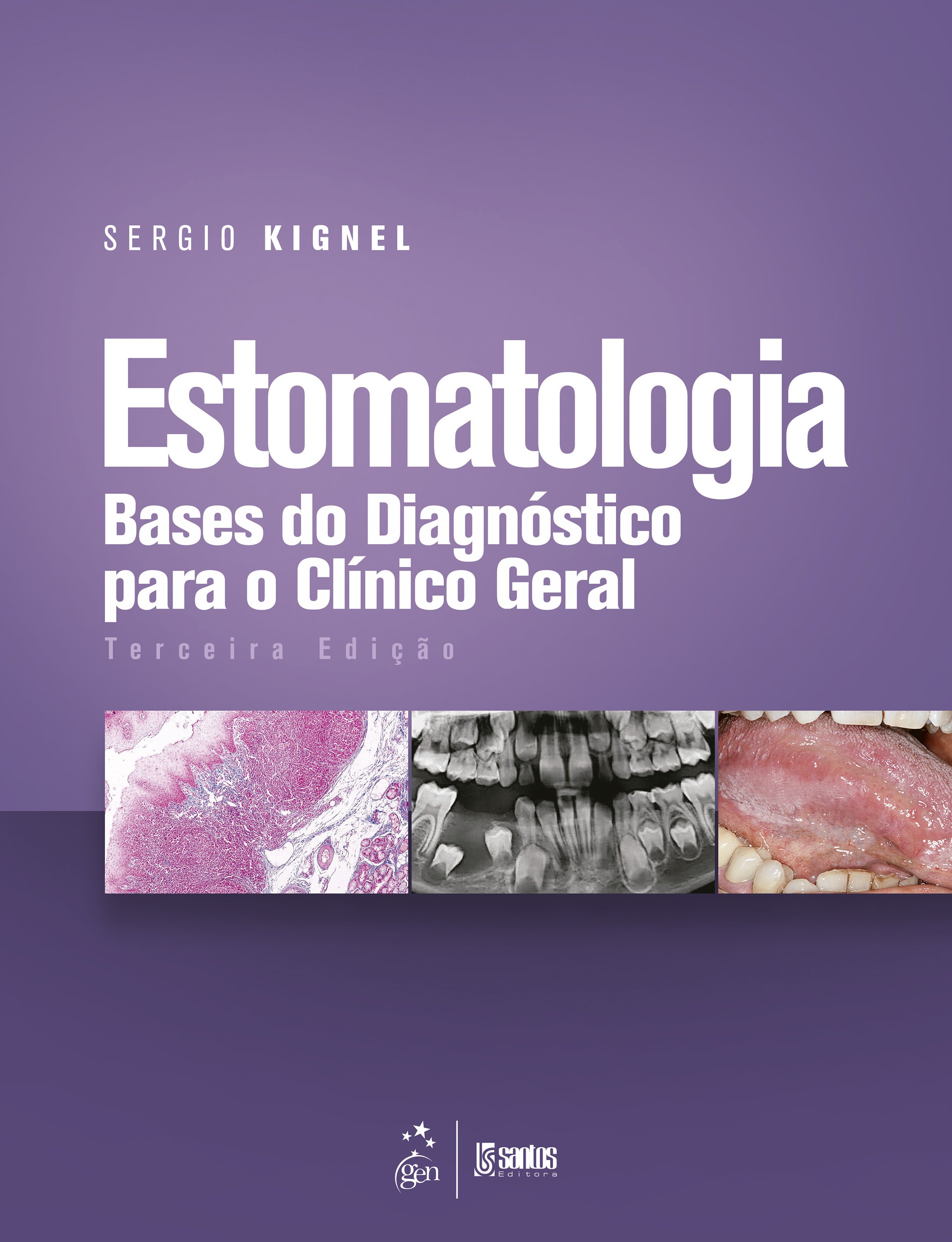 Estomatologia - Bases do Diagnóstico Para o Clínico Geral - 03Ed/20