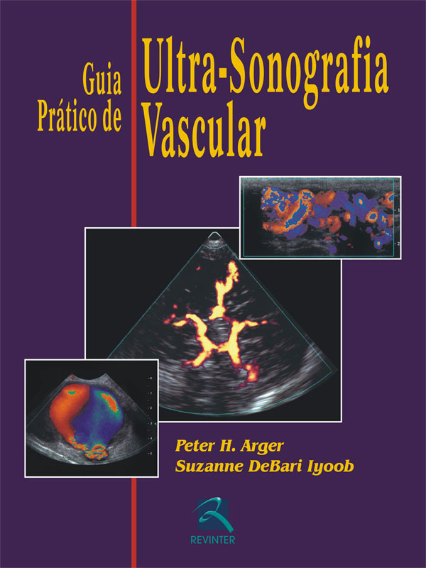 Guia Prático De Ultrassonografia Vascular