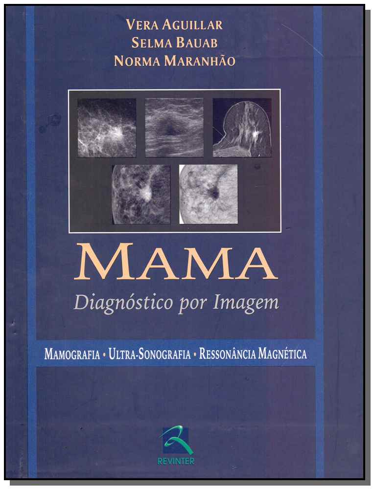 Mama - Diagnóstico por Imagem