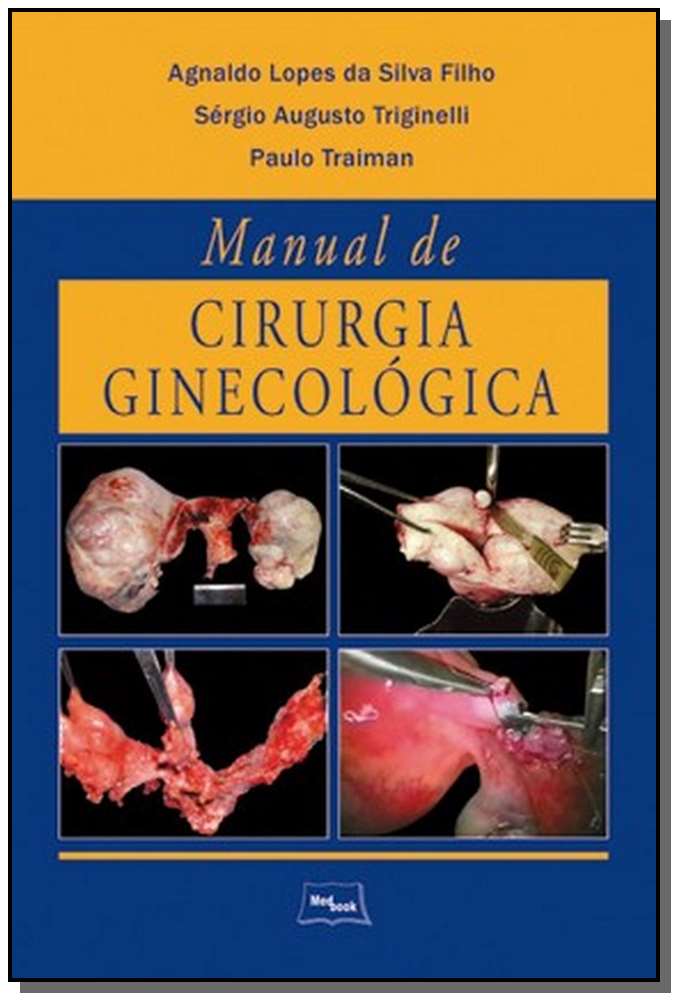 Manual de Cirurgia Ginecologica