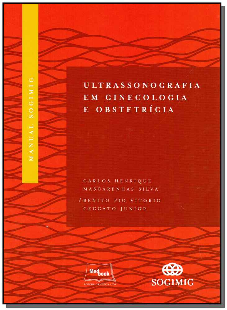 Manual Sogimig - Ultrassonografia em Ginecologia e Obstetrícia