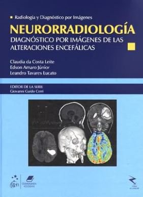 Neurorradiologia - Diagnostico Por Imagenes De Las