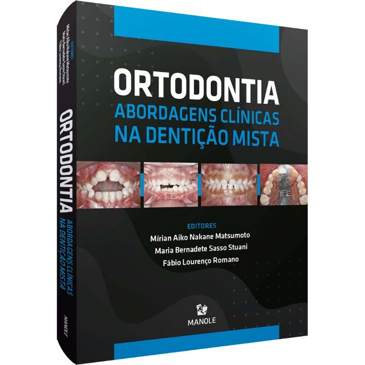 Ortodontia - Abordagens clínicas na dentição mista