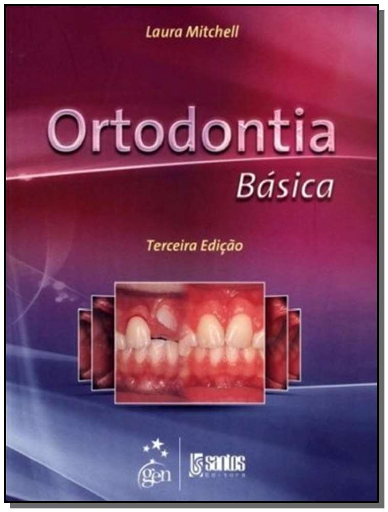 Ortodontia Básica - 03Ed/13