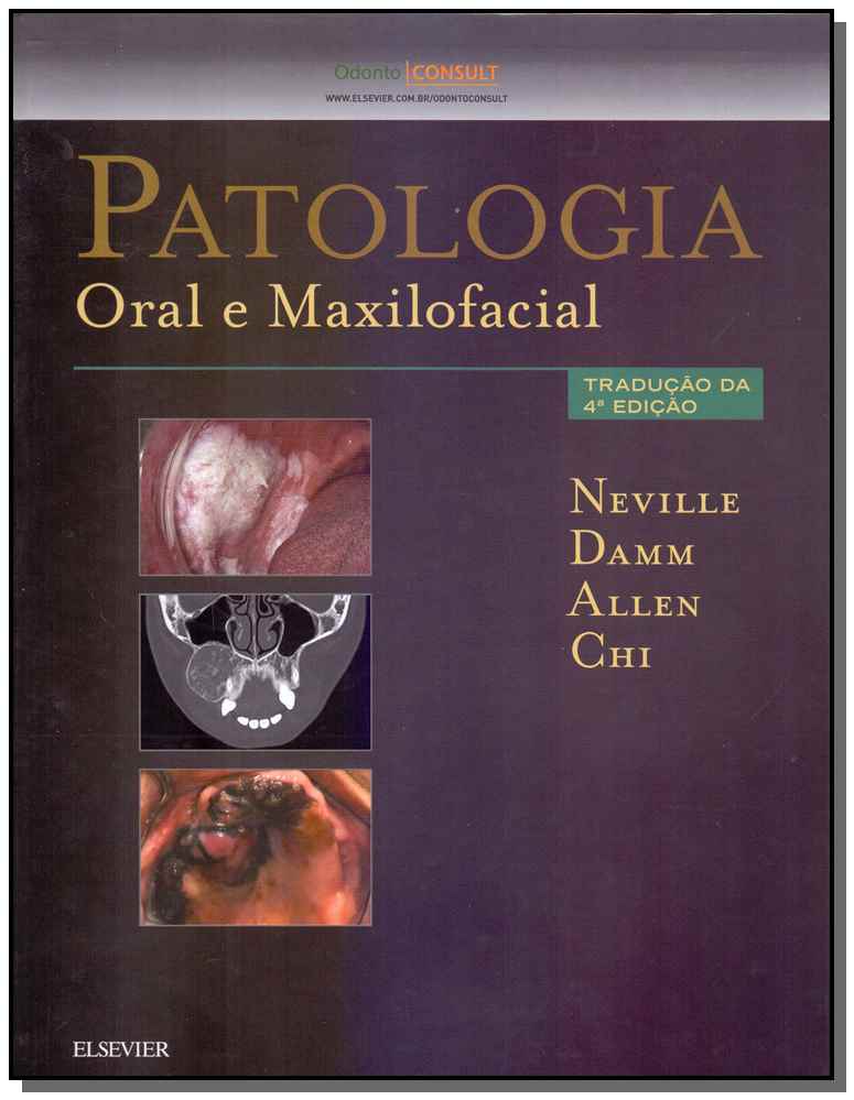 Patologia Oral e Maxilofacial