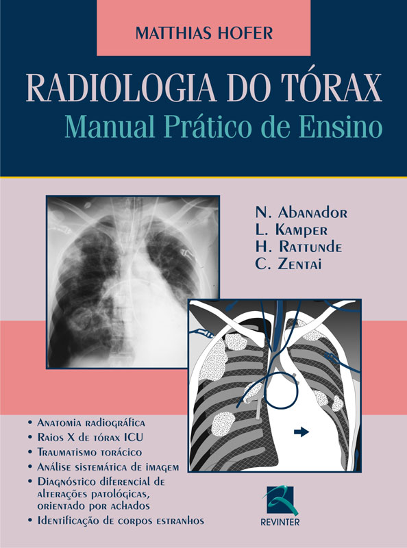 Radiologia Do Tórax