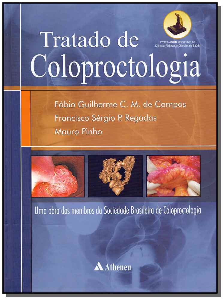 Tratado de Coloproctologia