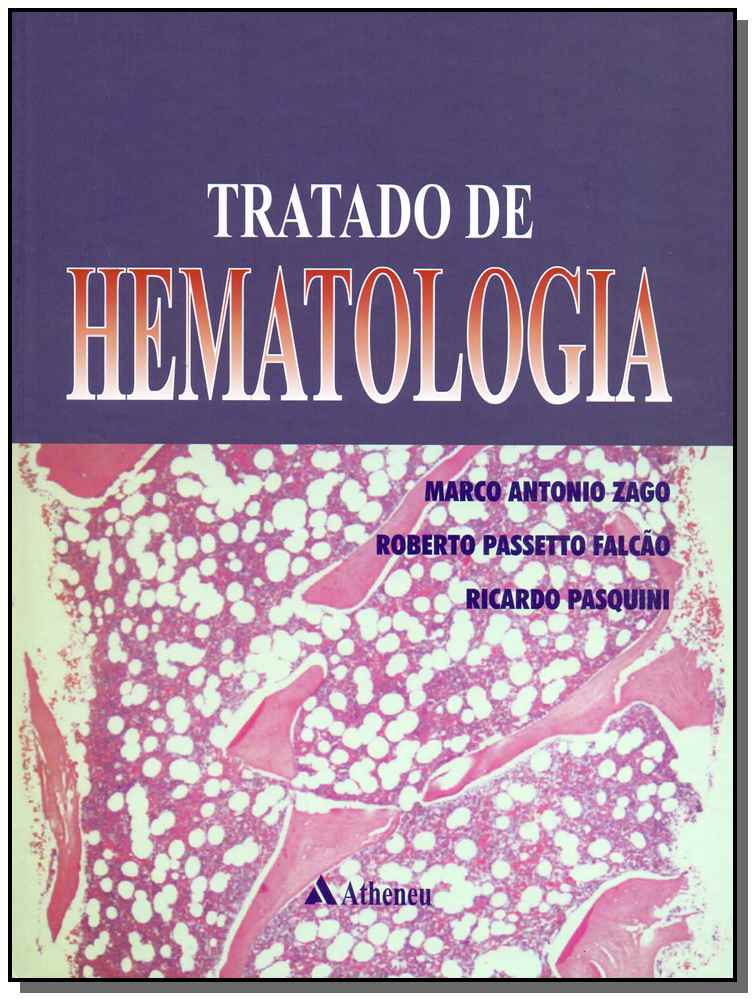 Tratado de Hematologia