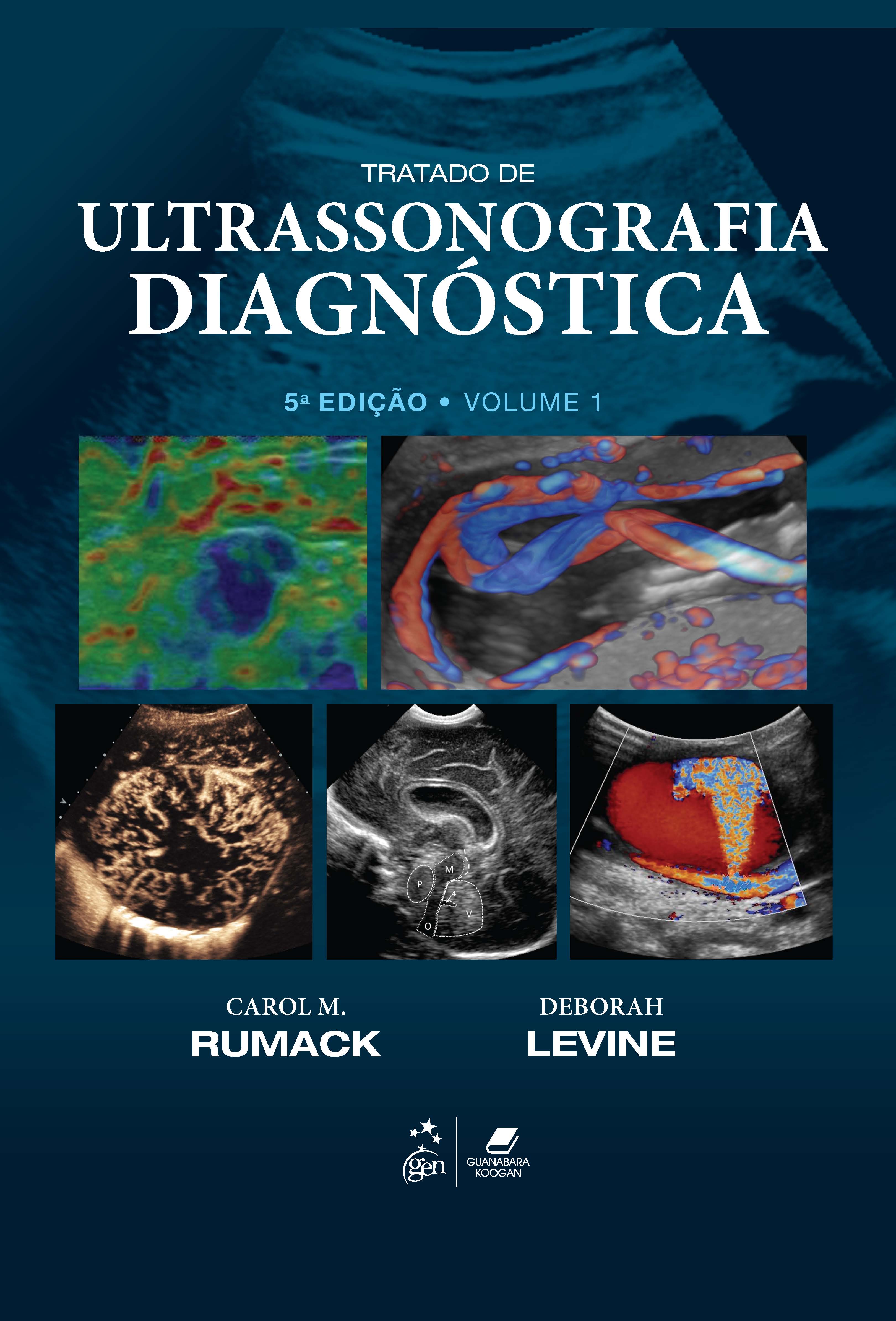 Tratado de Ultrassonografia Diagnóstica - 05ed/20