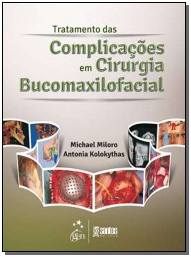 Tratamento das Complicações em Cirurgia Bucomaxilofacial - 01Ed/13