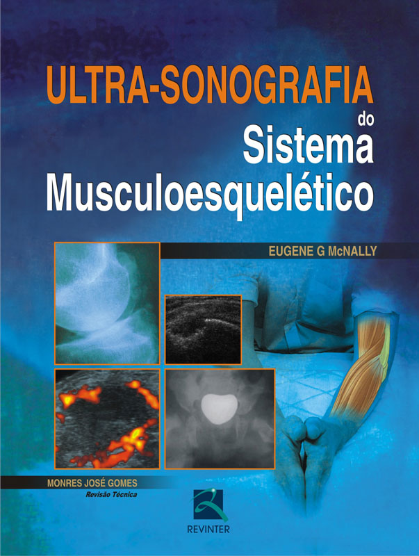 Ultrassonografia Do Sistema Musculoesquelético