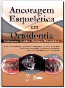 Ancoragem Esquelética em Ortodontia - 02Ed/13