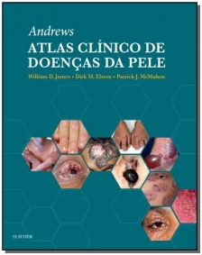 Andrew Atlas Clinico de Doencas da Pele