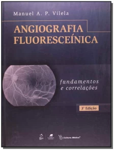 Angiografia Fluoresceinica - Fundamentos e Correla