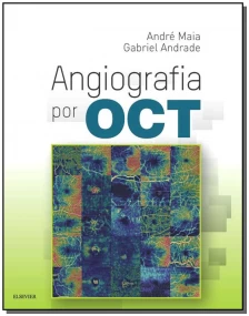 Angiografia por OCT