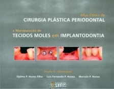 Atlas Clínico de Cirurgia Plástica Periodontal e Manip. de Tecidos Moles em Implantodontia - 01Ed/07