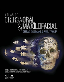 Atlas de Cirurgia Oral e Maxilofacial