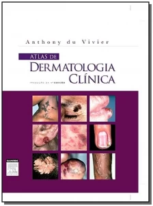 Atlas de Dermatologia Clinica