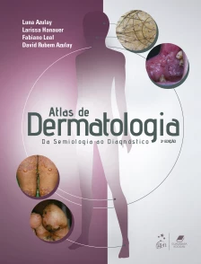 Atlas De Dermatologia - Da Semiologia Ao Diagnostc