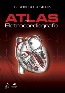 Atlas de Eletrocardiografia