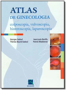 Atlas de Ginecologia