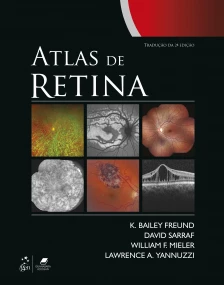 Atlas de Retina