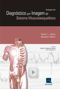 Avanços Em Diagnósticos Por Imagem Do Sistema Musculoesquelético