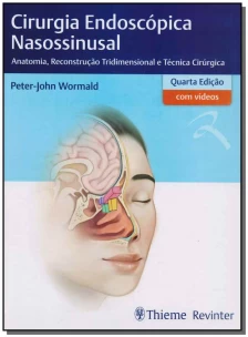 Cirurgia Endoscópica Nasossinusal - 04Ed/18