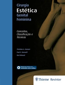 Cirurgia Estética Genital Feminina