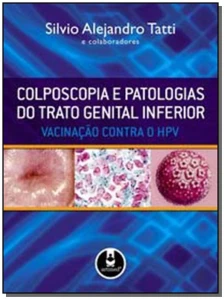 Colposcopia e Patologias Do Trato Genital Inferior