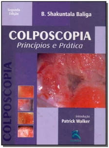 Colposcopia - Princípios e Prática - (4740)