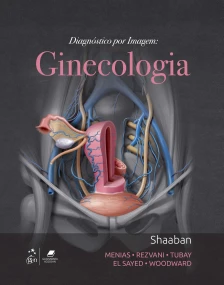 Diagnostico por Imagem - Ginecologia