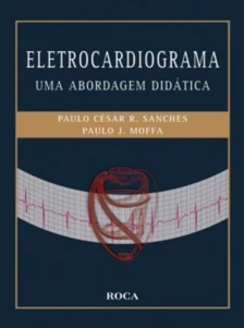 Eletrocardiograma - Uma Abordagem Didática