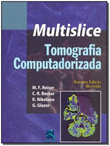 Multislice - Tomografia Computadorizada